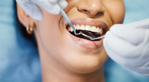 Best Emergency Dental Care for Sports Injuries in Ben Wheeler, TX