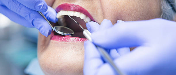 Best Emergency Wisdom Tooth Extraction in Ben Wheeler, TX
