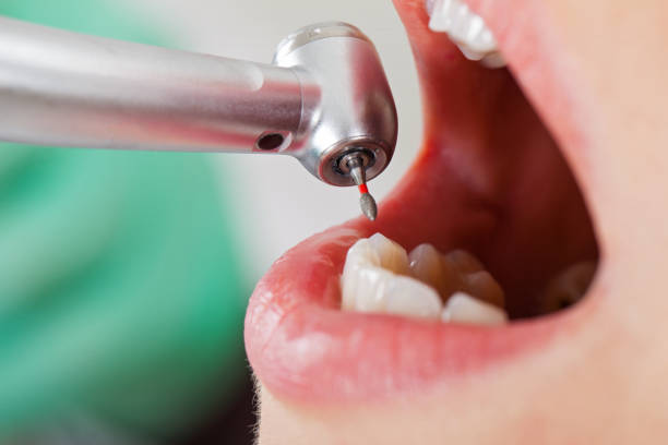 Best Emergency Pediatric Dental Care in Ben Wheeler, TX